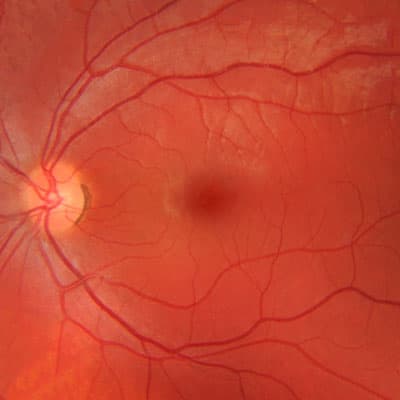 Blood vessels